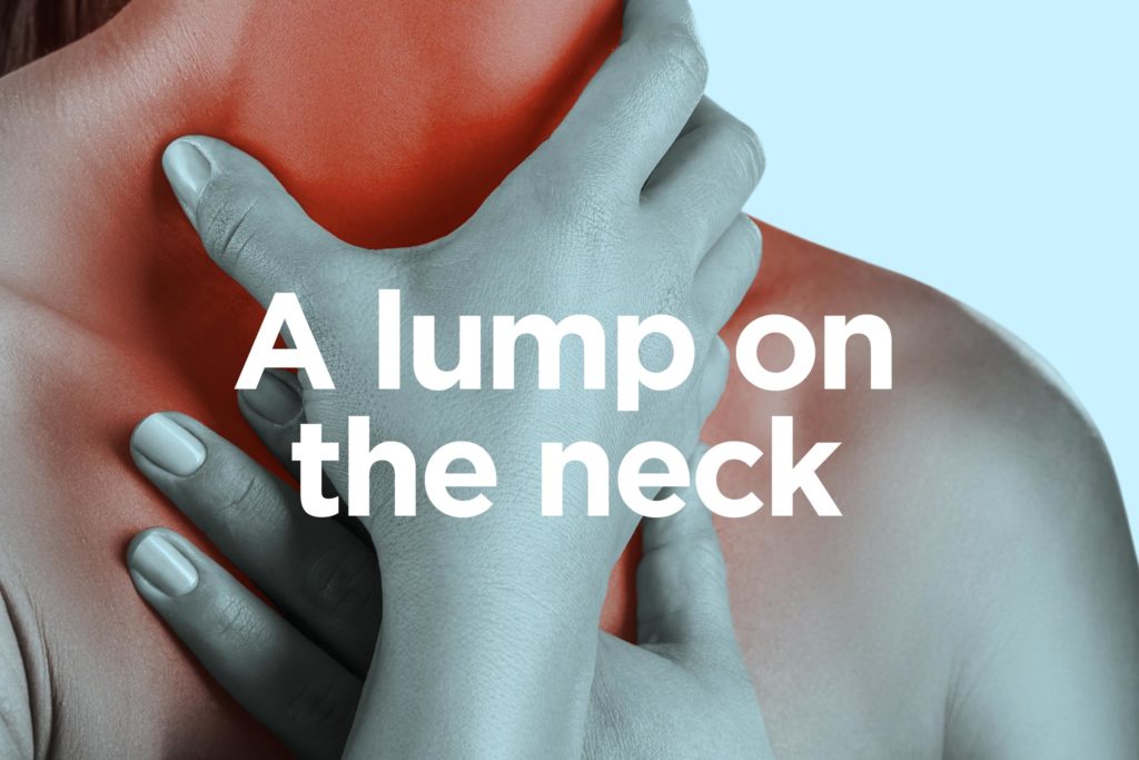 Throat_Cancer_Signs_Lump_Neck