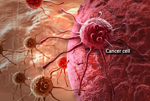 -cancer-cell