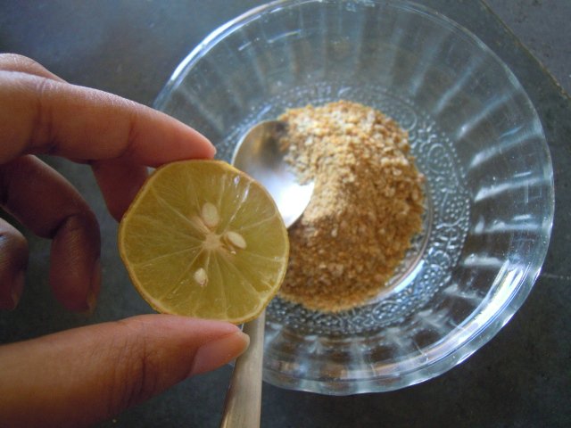 home-made-dandruff-remedy-